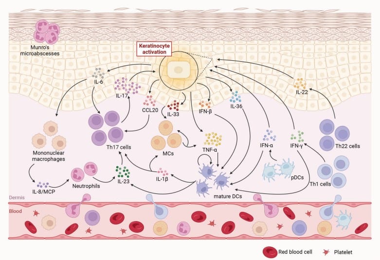 건선 원리
psoriasis mechanism